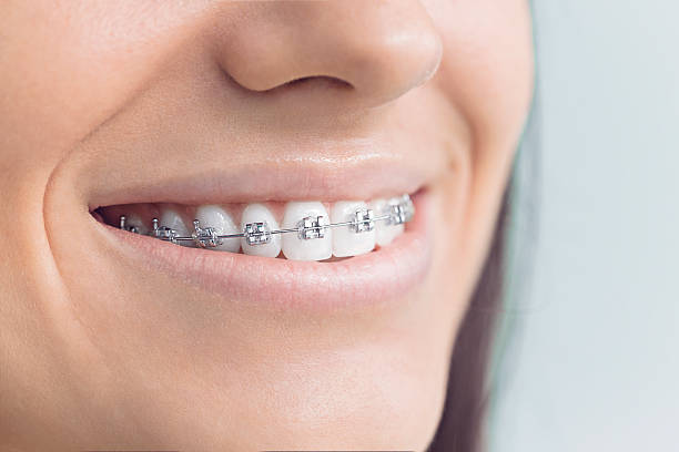 Best Teeth Whitening  in Angleton, TX